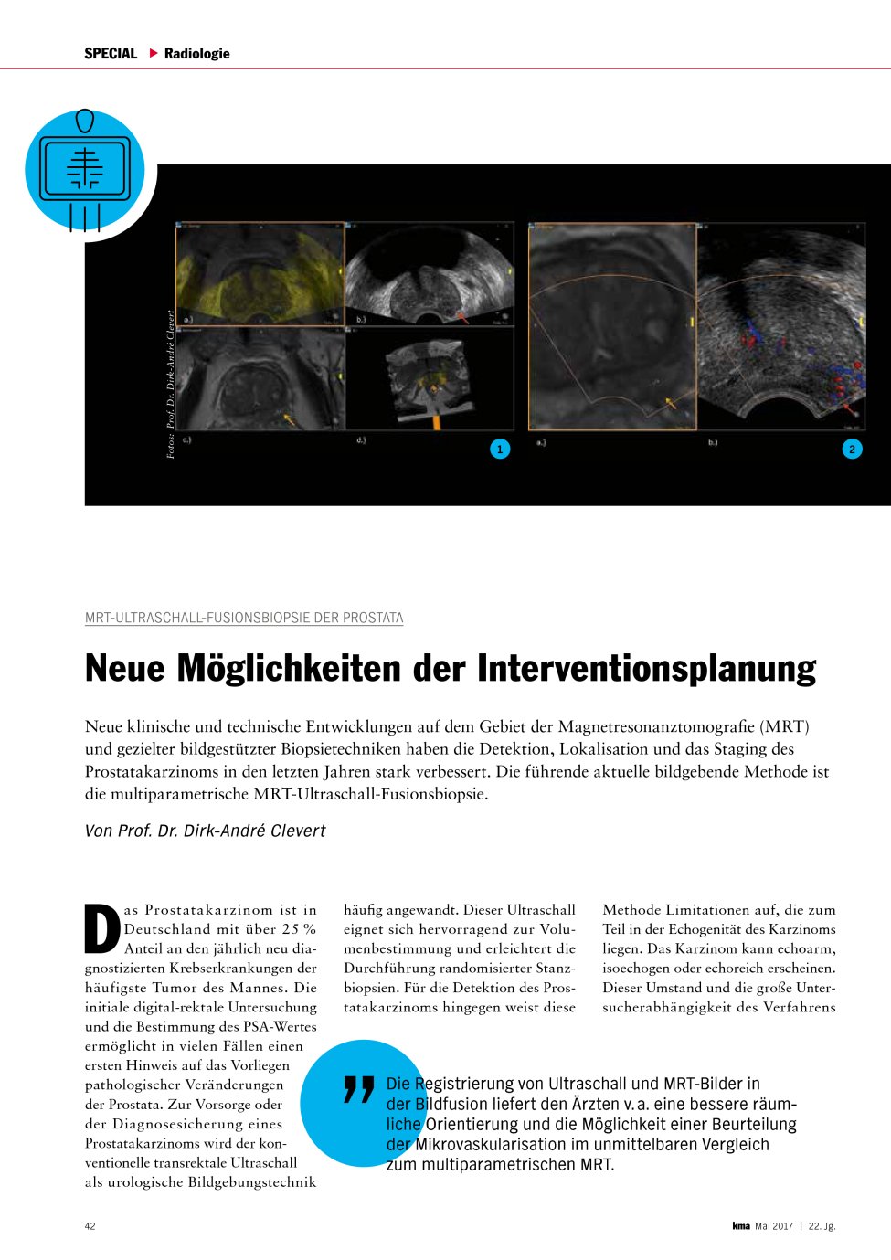 Vorschauseite 1: MRT-Ultraschall-Fusionsbiopsie der Prostata: Neue Möglichkeiten der Interventionsplanung