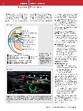 Vorschauseite 3: Intermediäre Plexus-cervicalis-Blockade zur Anlage eines zentralvenösen Katheters. Eine randomisierte, kontrollierte Studie zur Verbesserung der Analgesie.