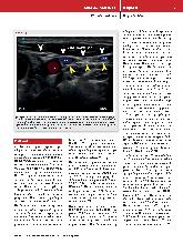 Vorschauseite 4: Intermediäre Plexus-cervicalis-Blockade zur Anlage eines zentralvenösen Katheters. Eine randomisierte, kontrollierte Studie zur Verbesserung der Analgesie.