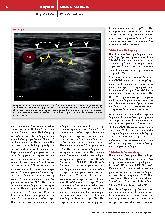 Vorschauseite 5: Intermediäre Plexus-cervicalis-Blockade zur Anlage eines zentralvenösen Katheters. Eine randomisierte, kontrollierte Studie zur Verbesserung der Analgesie.