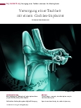Vorschauseite 1: Versorgung einer Taubheit mit einem Cochlea-Implantat