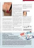 Vorschauseite 4: Narben postoperativ behandeln