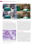 Vorschauseite 3: Mycobacterium chimaera Internationaler Infektionsausbruch durch einen ungewöhnlichen Erreger