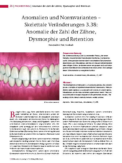 Vorschauseite 1: Anomalien und Normvarianten – Skelettale Veränderungen 3. 38: Anomalie der Zahl der Zähne, Dysmorphie und Retention
