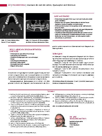 Vorschauseite 3: Anomalien und Normvarianten – Skelettale Veränderungen 3. 38: Anomalie der Zahl der Zähne, Dysmorphie und Retention