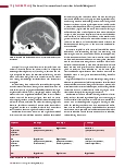 Vorschauseite 3: Die Sinus-/Hirnvenenthrombose in der Schnittbilddiagnostik
