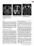 Vorschauseite 4: Die Sinus-/Hirnvenenthrombose in der Schnittbilddiagnostik