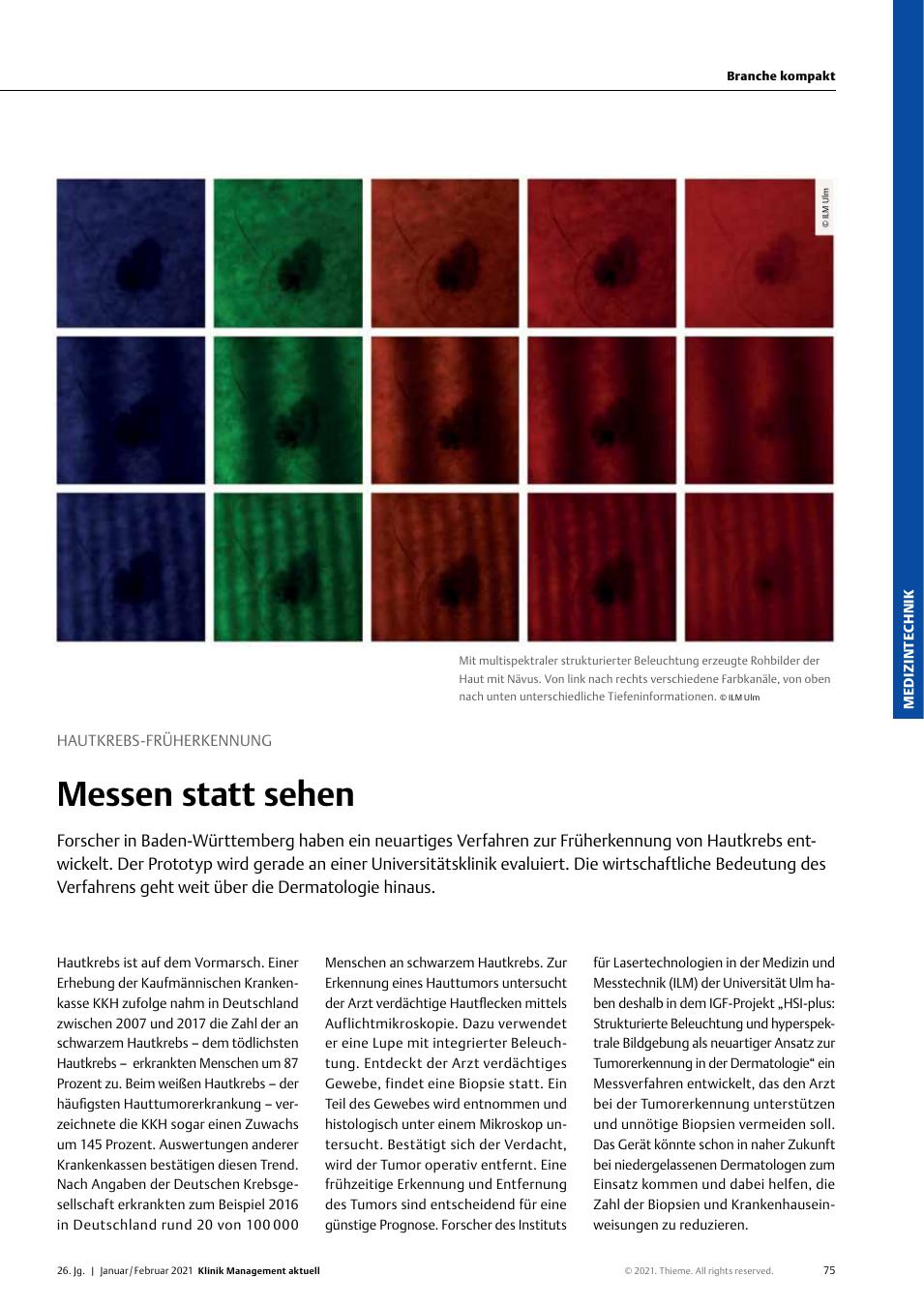 Vorschauseite 1: Hautkrebs-Früherkennung: Messen statt sehen