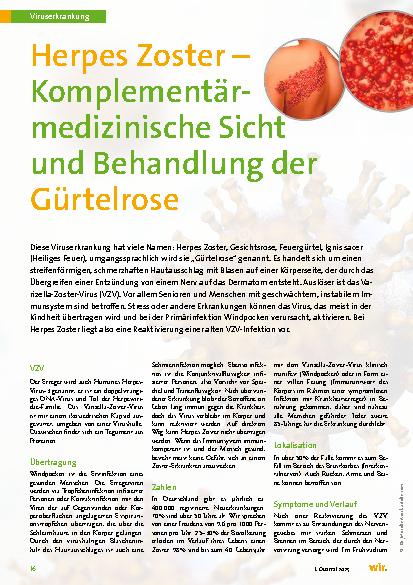 Vorschauseite 1: Herpes Zoster – Komplementärmedizinische Sicht und Behandlung der Gürtelrose