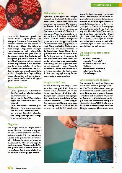 Vorschauseite 2: Herpes Zoster – Komplementärmedizinische Sicht und Behandlung der Gürtelrose