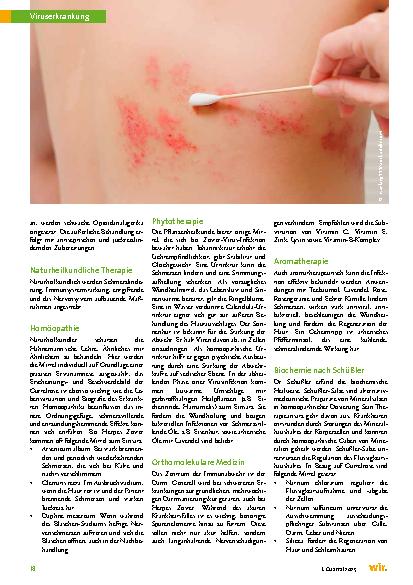 Vorschauseite 3: Herpes Zoster – Komplementärmedizinische Sicht und Behandlung der Gürtelrose