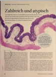 Vorschauseite 1: Zahlreich und atypisch