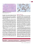 Vorschauseite 2: Die Prostata-Immunhistochemie kann bei der Differenzialdiagnose hilfreich sein.