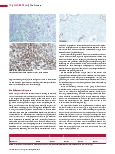 Vorschauseite 3: Die Prostata-Immunhistochemie kann bei der Differenzialdiagnose hilfreich sein.