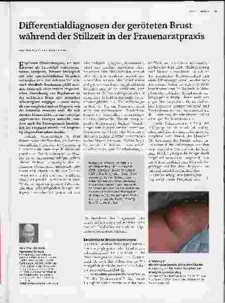 Vorschauseite 1: Differentialdiagnosen der geröteten Brust während der Stillzeit in der Frauenarztpraxis