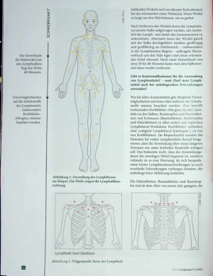 Vorschauseite 4: Faszination Lymphe Ein praxisnaher Blick auf Behandlungsstrategien