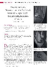 Vorschauseite 1: Anomalien und Normvarianten: Skelettale Veränderungen 3.33 - Nicht ossifizierendes Fibrom