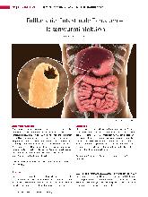 Vorschauseite 1: Fallbeispiel Intestinale Parasiten - Hakenwurminfektion