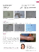 Vorschauseite 2: Fallbeispiel Intestinale Parasiten - Hakenwurminfektion