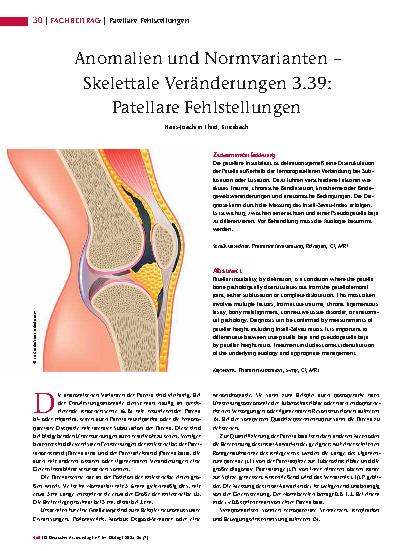 Vorschauseite 1: Anomalien und Normvarianten – Skelettale Veränderungen 3. 39: Patellare Fehlstellungen