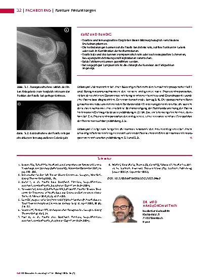 Vorschauseite 3: Anomalien und Normvarianten – Skelettale Veränderungen 3. 39: Patellare Fehlstellungen