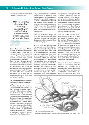 Vorschauseite 2: Selten, aber zu häufig diagnostiziert und schwindelerregend Die Menièresche Erkrankung
