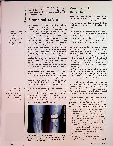 Vorschauseite 2: Auf Spurensuche: Das Knie aus osteopathischer Sicht