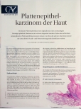 Vorschauseite 1: Plattenepithelkarzinom der Haut