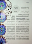 Vorschauseite 2: Vorbeugende Therapie