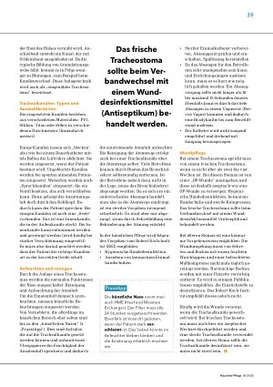 Vorschauseite 2: Versorgung des Tracheostomas – aktuell empfohlene Vorgehensweisen