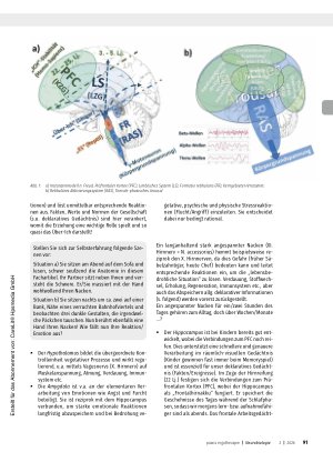 Vorschauseite 5: Stagnierende Behandlungsergebnisse bei Epicondylitis?