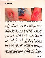 Vorschauseite 3: Wundbehandlung mit Kaltplasma