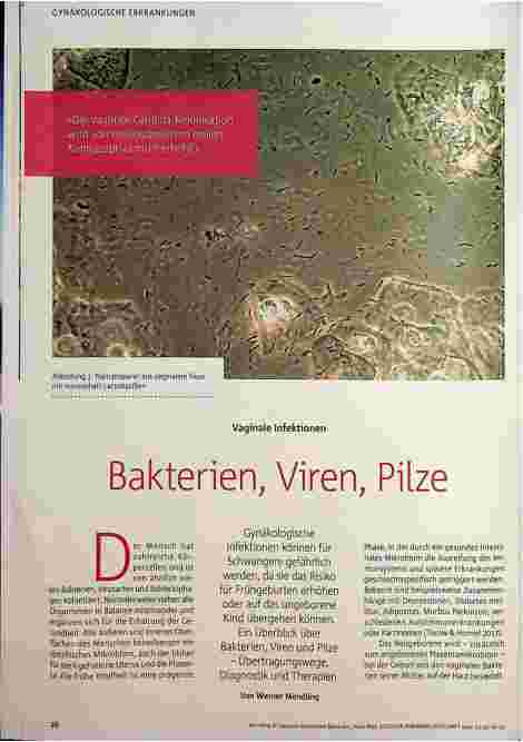 Vorschauseite 1: Vaginale Infektionen: Bakterien, Viren, Pilze