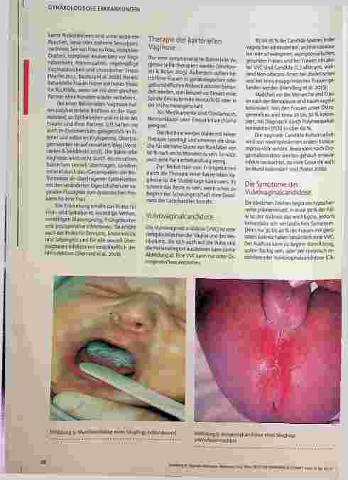 Vorschauseite 3: Vaginale Infektionen: Bakterien, Viren, Pilze