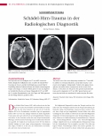 Vorschauseite 1: Schädel-Hirn-Trauma in der Radiologischen Diagnostik
