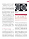 Vorschauseite 2: Schädel-Hirn-Trauma in der Radiologischen Diagnostik