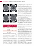 Vorschauseite 3: Schädel-Hirn-Trauma in der Radiologischen Diagnostik