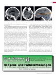 Vorschauseite 4: Schädel-Hirn-Trauma in der Radiologischen Diagnostik