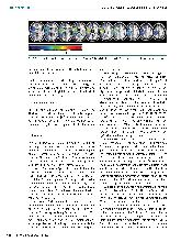 Vorschauseite 5: Eine Pilotstudie zur Behandlung der kontraversiven Lateropulsion (»Pusher-Syndrom«) durch Prismenadaption