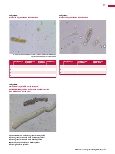 Vorschauseite 2: Repetitorium: Urinsedimentquiz (Teil 2)