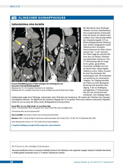 Vorschauseite 1: Gallensteinileus ohne Aerobilie