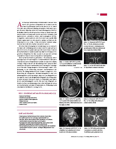 Vorschauseite 2: Anomalien und Normvarianten – Zerebrale Diagnostik 1. 9: Zerebrale arteriovenöse Malformation