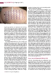 Vorschauseite 3: Allergologie (Teil 7) Krankheitsbilder (II)