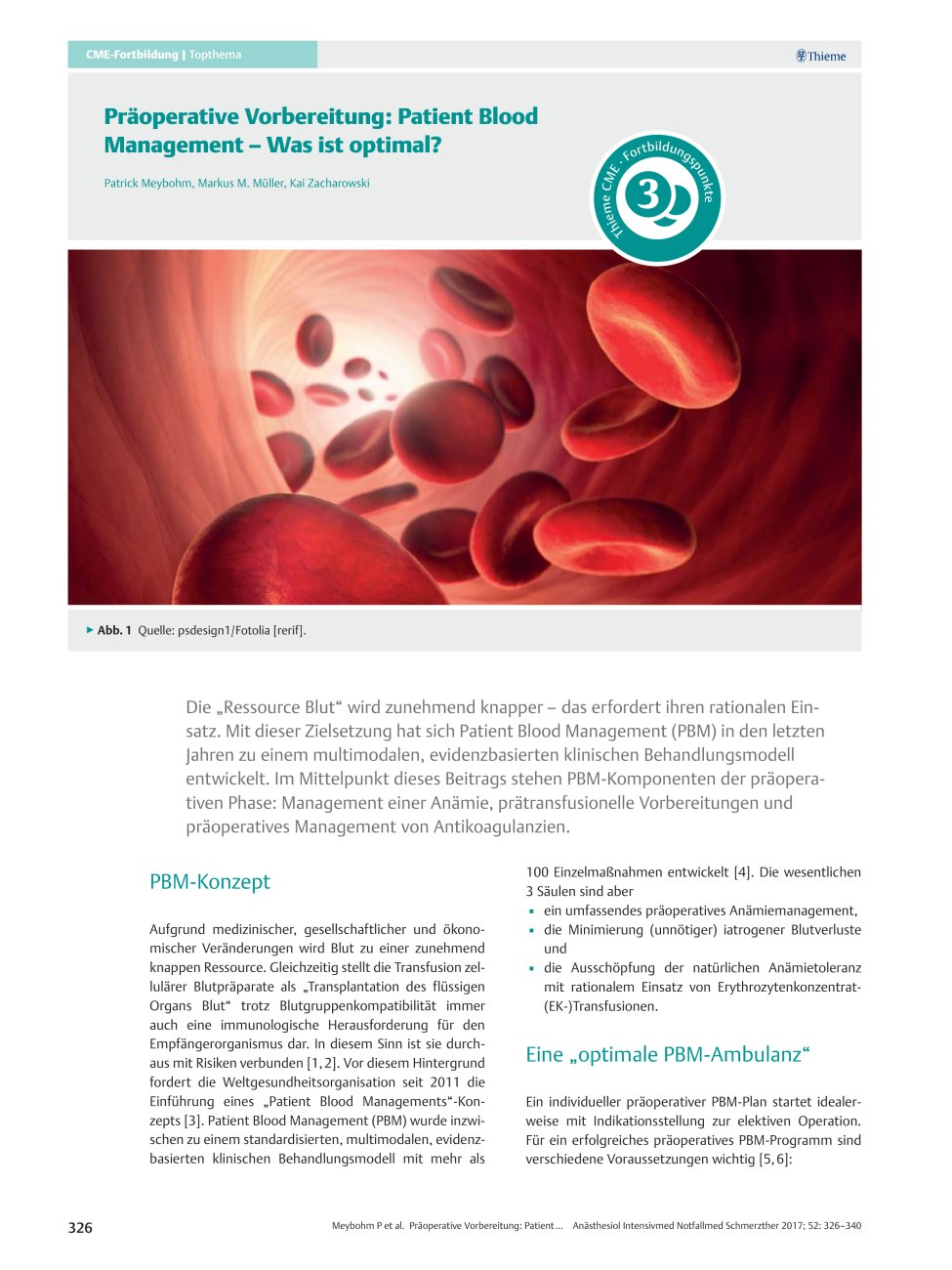 Vorschauseite 1: Präoperative Vorbereitung: Patient Blood Management – Was ist optimal?