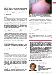 Vorschauseite 2: ECHO-Viren – gefährlich für Neugeborene