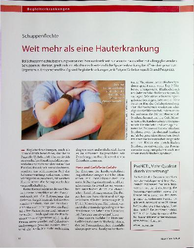 Vorschauseite 1: Schuppenflechte: Weit mehr als eine Hauterkrankung