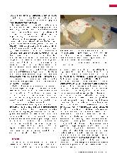 Vorschauseite 4: Listeriose: Eine lebensmittelbedingte Infektion, besonders gefährlich für Alte, Abwehrgeschwächte und Schwangere.