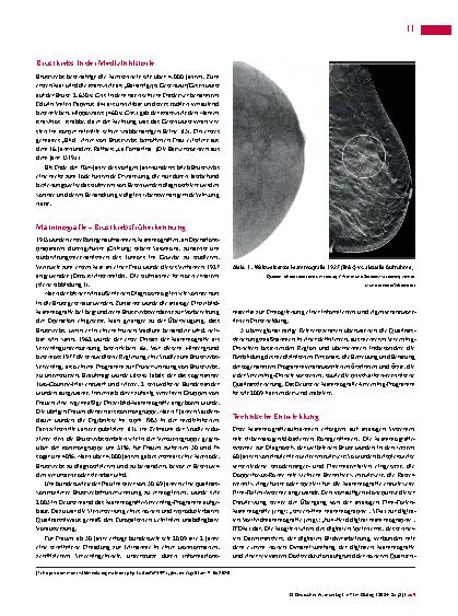 Vorschauseite 2: Entwicklung der Brustkrebsdiagnostik: Das Mammografie-Screening-Programm als Motor
