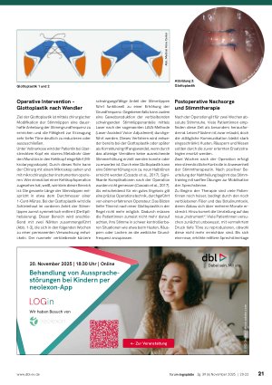 Vorschauseite 2: Stimmfeminisierung im Team Glottoplastik und Stimmtherapie: Zwei Säulen der geschlechtsangleichenden Stimmarbeit