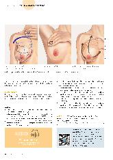 Vorschauseite 3: Paradigmenwechsel im Umgang mit Mastitis (Teil 2)